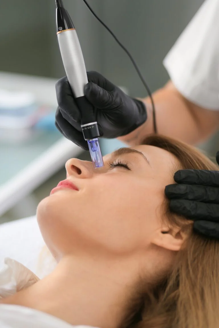 micro-needling Dermapen (μεσοθεραπεία προσώπου)